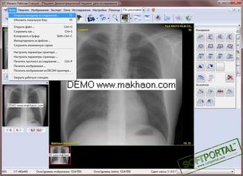 Махаон PACS скриншот № 1